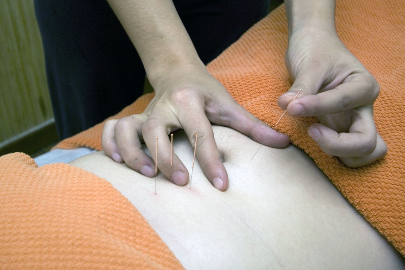 osteopathe-PIERREFEU DU VAR-min_acupuncture-4175625